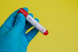 Hepatitída